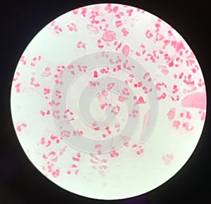 Slide show Gram negative diplococci in pus from penis