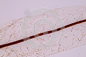 Slime molds, as a group, are polyphyletic.