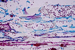 Slime molds, as a group, are polyphyletic.