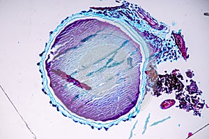 Slime molds, as a group, are polyphyletic.