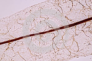Slime molds, as a group, are polyphyletic.