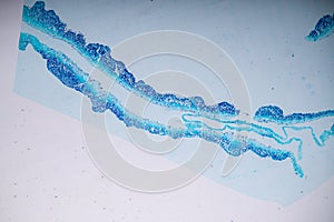 Slime molds, as a group, are polyphyletic.
