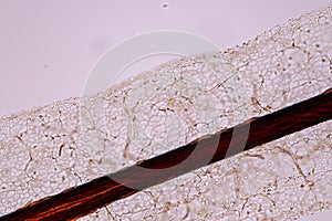 Slime molds, as a group, are polyphyletic.