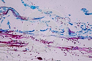 Slime molds, as a group, are polyphyletic.