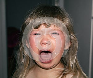 A small child is crying with tears and drooling. Children`s hysteria.