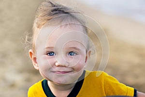 Small child with redness on the skin, suffering from food allergies.