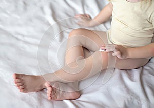 A small child rubs a children`s healing cream on the skin of a knee. The concept of treatment of skin irritation, allergies and