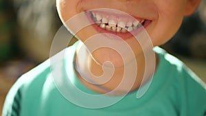 A small child shows emotions: laughter, happiness, joy, smile. Close-up of a child`s mouth. A child demonstrates teeth.