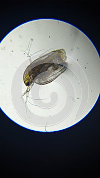 A small daphnia under a microscope.