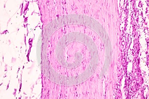 Small intestine Duodenum and Vermiform appendix  Human under the microscope.