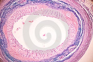 Small intestine Duodenum and Vermiform appendix  Human under the microscope.