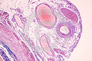 Small intestine Duodenum and Vermiform appendix  Human under the microscope.