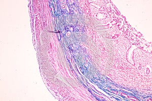 Small intestine Duodenum and Vermiform appendix  Human under the microscope.