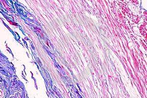 Small intestine Duodenum and Vermiform appendix  Human under the microscope.