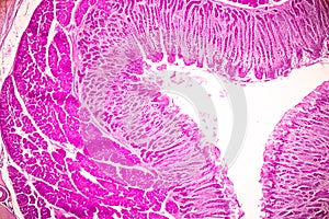 Small intestine Duodenum and Vermiform appendix  Human under the microscope.