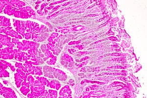 Small intestine Duodenum and Vermiform appendix  Human under the microscope.