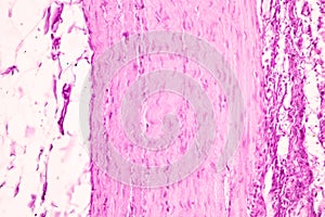 Small intestine Duodenum and Vermiform appendix  Human under the microscope.