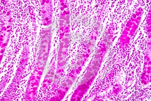 Small intestine Duodenum and Vermiform appendix  Human under the microscope.