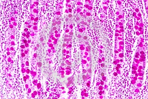 Small intestine Duodenum and Vermiform appendix  Human under the microscope.