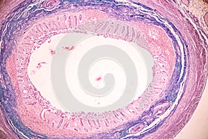 Small intestine Duodenum and Vermiform appendix  Human under the microscope.