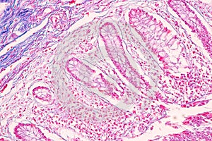 Small intestine Duodenum and Vermiform appendix  Human under the microscope.