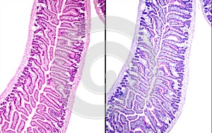 Small intestine. Goblet cells