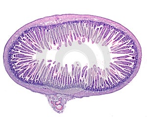 Small intestine. Intestinal villi