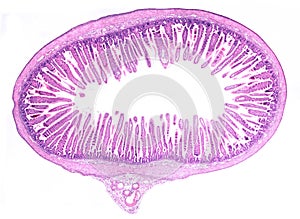 Small intestine. Villi