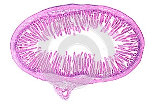 Small intestine. Villi