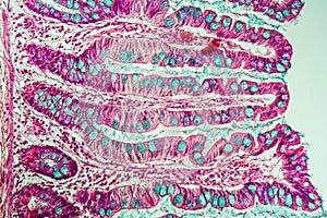 Small intestine with villi under the microscope