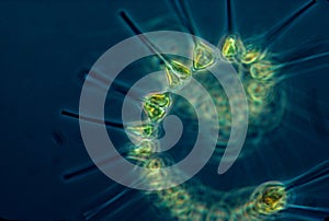 Small but mighty  phytoplankton are the laborers of the ocean.