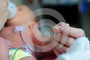 Small premature baby in ICU