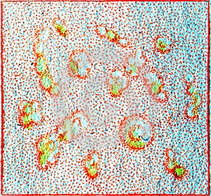 Smallpox discrete, vintage engraving