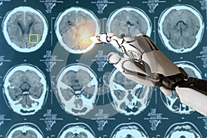 smart medical concept, artificial intelligence use for detect cancer or injury in brain it use deep learning brought what is known