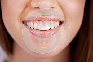 Smile, dental and closeup of woman teeth with health, wellness and clean routine for hygiene. Oral care, happy and zoom