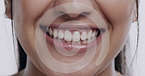 Smile, person and teeth whitening with closeup of mouth, orthodontics and wellness for oral health on white background