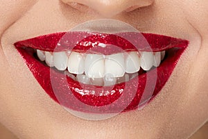 Smile With Red Lips And White Teeth photo
