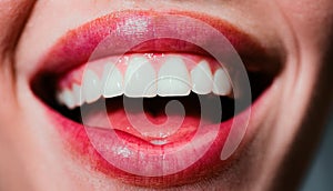 Smile teeth. Laughing woman mouth with great teeth close up. Healthy white teeth. Closeup of smile with white healthy