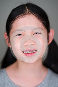 Smiling Asian Girl with Dental Braces