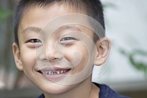 Smiling boy with missing teeth
