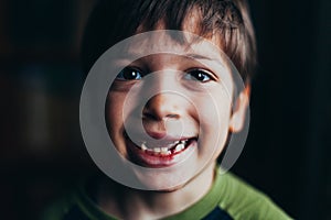 Smiling boy with missing teeth