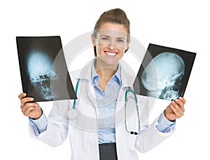 Smiling doctor woman holding fluorography