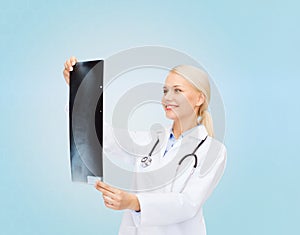 Smiling female doctor looking at x-ray image