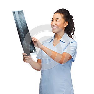 Smiling female doctor or nurse looking at x-ray