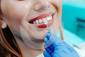 Smiling female mouth with natural white teeth in light blue background in dental clinic. Hands doctor dentist with teeth color