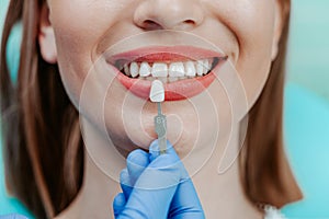 Smiling female mouth with natural white teeth in light blue background in dental clinic. Hands doctor dentist with teeth color