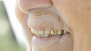 Smiling mouth of old woman with false teeth