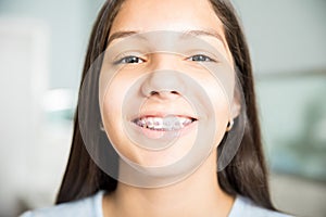 Smiling Teenage Girl Wearing Braces At Dental Clinic