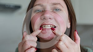 Smiling Woman With Braces Speaking About Dental Care Indoors During Daytime