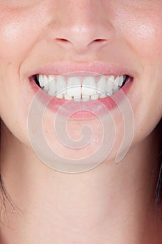 Smiling woman mouth with great teeth